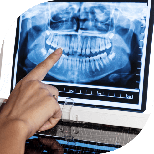 Digital dental x-rays