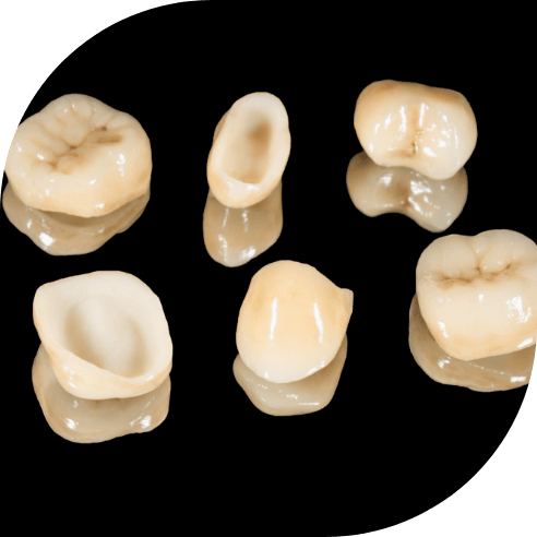 Several different types of natural and ceramic dental restorations