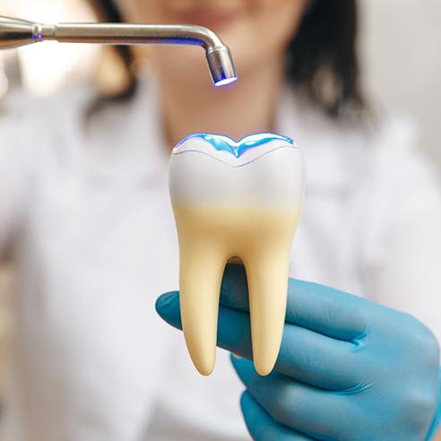 A dentist illustrating the dental filling process