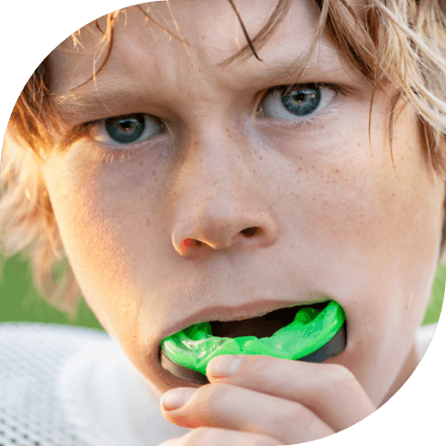 Teen placing an athletic mouthguard